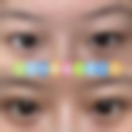 五、东莞紫芯医疗美容医院价格表