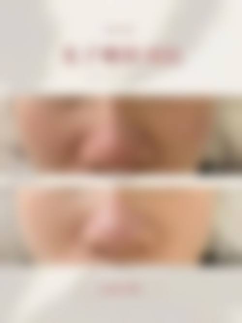 九、十堰安琪儿医学美容中 心真实的患者评价