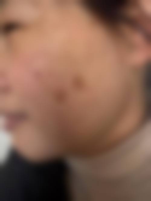 六、郝宝慧真实的患者评价