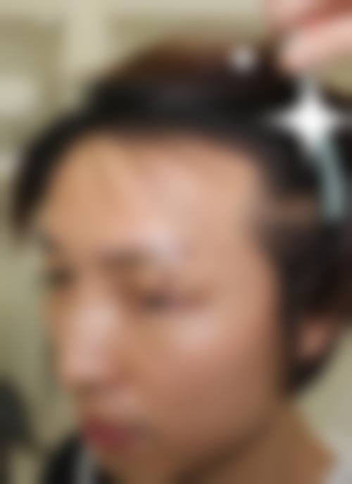 八、南方医 科 大学附属何贤纪念医院烧伤整形科真实的患者评价