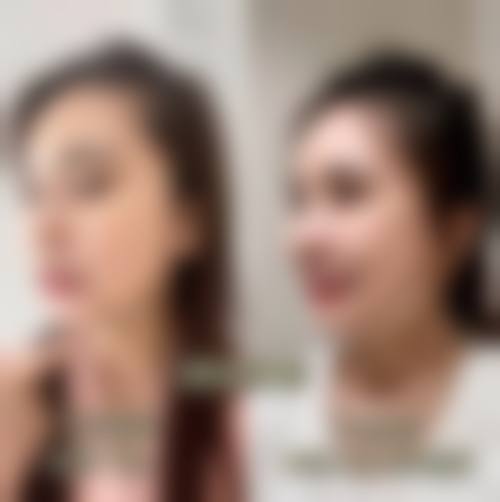 八、南通赛娜美医疗美容诊所真实的患者评价
