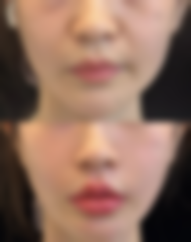 五、南通赛娜美医疗美容诊所价格表