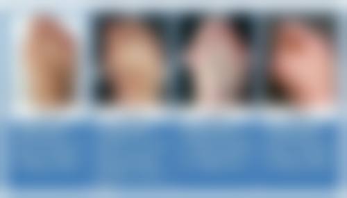 六、吴卓伦真实的患者评价