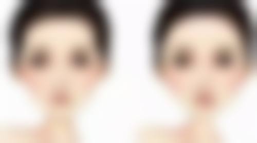 四、内吸去眼袋后需警惕的异常情况