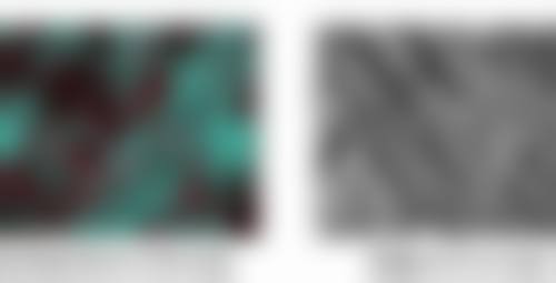 二、内吸去眼袋后淤青的修复时间