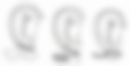 怎样才能出双眼皮？非手术与手术方法全揭秘，助你拥有自然美眼！ 