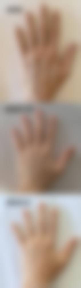 三、东莞天瑜医疗美容门诊部诊疗项目有哪些？