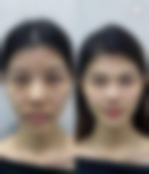 四、武汉星月汇医疗美容医院特色项目