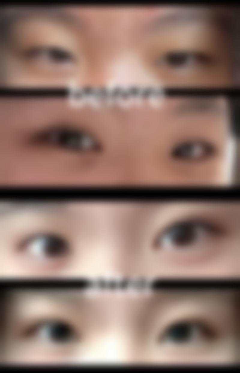 四、日本Theory美容整形医院特色项目