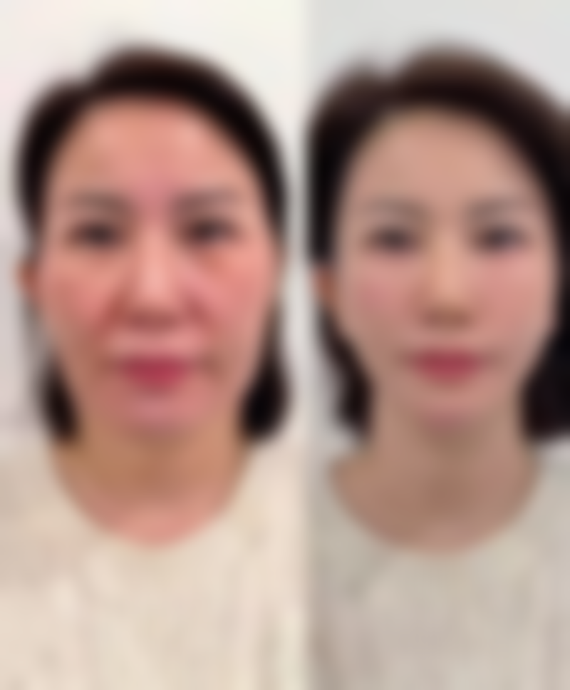 六、东莞天瑜医疗美容门诊部价格表