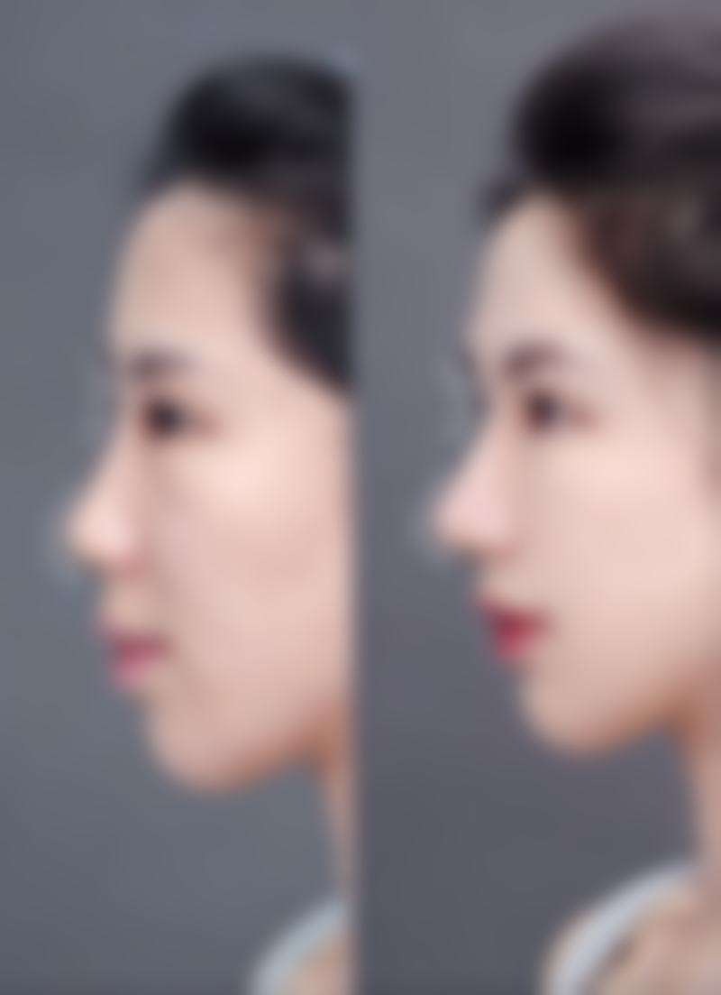 九、东莞天瑜医疗美容门诊部真实的患者评价