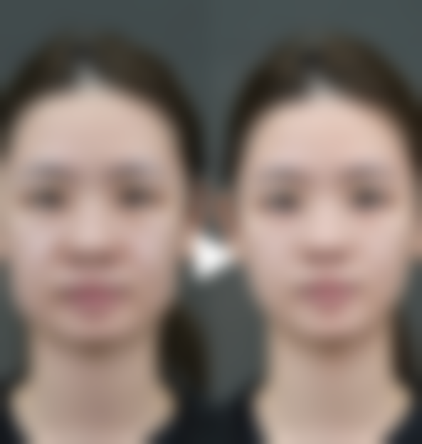 四、武汉斯启诺医疗美容门诊部项目价格及优势