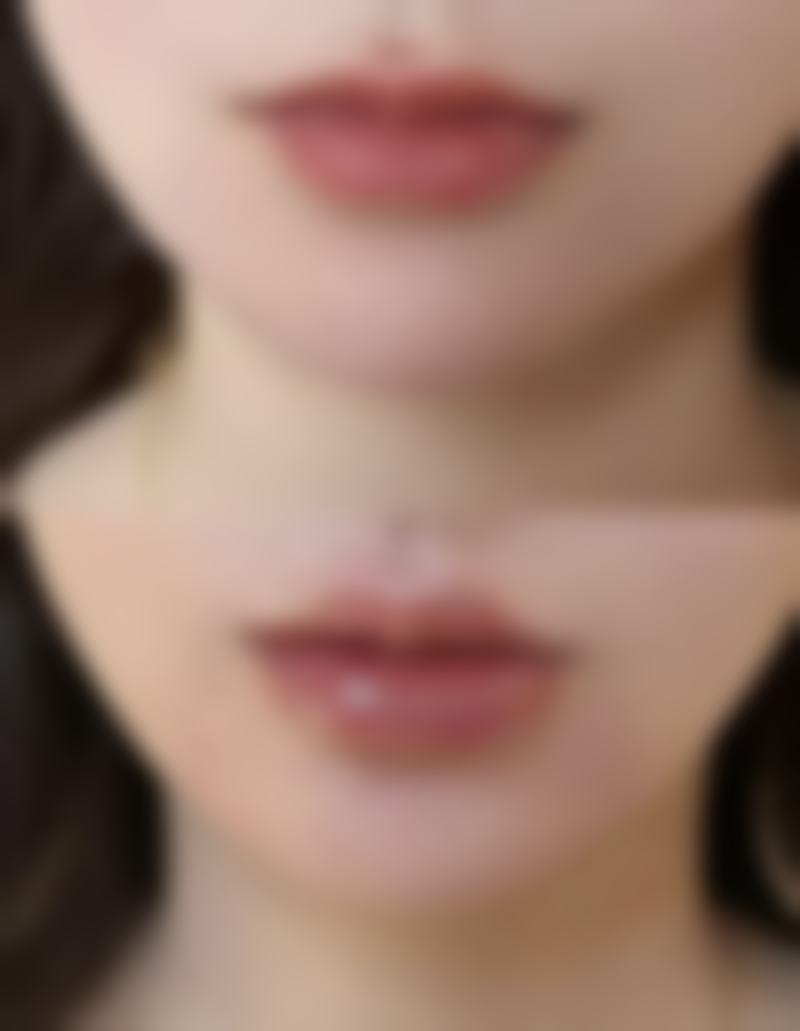 一、内吸去眼袋后淤青产生的原因