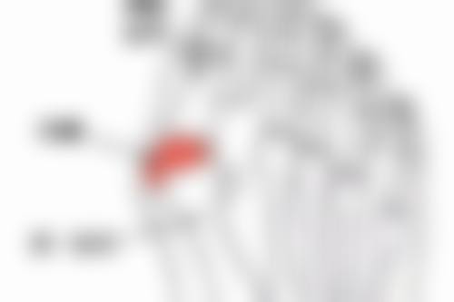 二、影响眼袋外切术后修复的因素