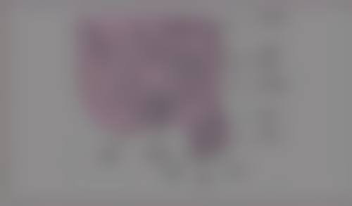 二、打水光眼袋肿了的修复方案与适用情况