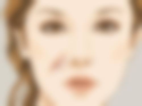 三、增生的疤痕分层治疗方案大公开