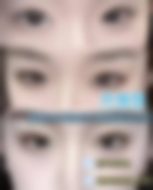 八、秦皇岛华韩整形医院真实的患者评价