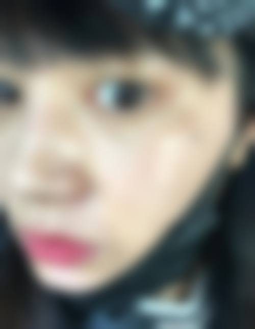 九、徐州医学校附属医院烧伤整形中 心真实的患者评价