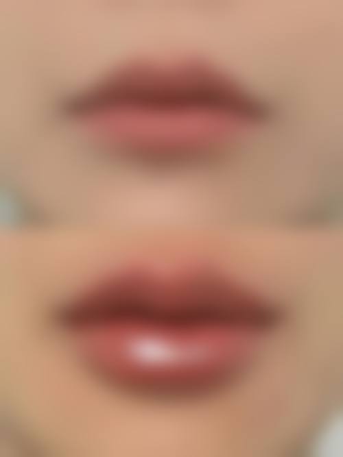 二、鞍山铁东区任凌莘医疗美容整形医院怎么样？