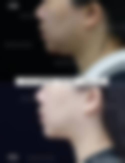 六、徐州医学校附属医院烧伤整形中 心价格表