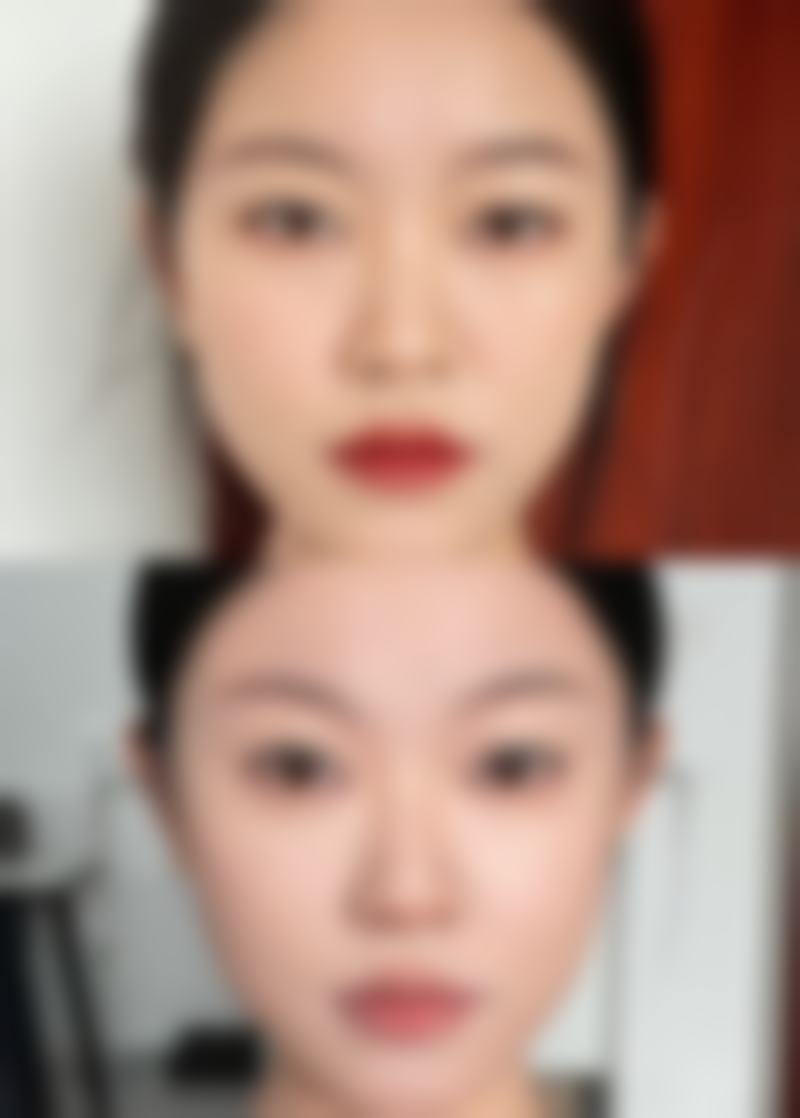 三、常见的治疗方法