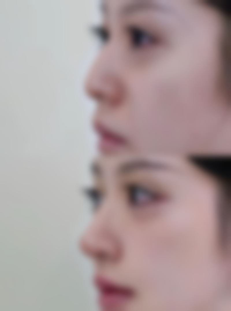 三、鞍山铁东区任凌莘医疗美容整形医院诊疗项目有哪些？