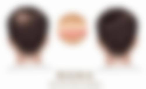 一、兰州青丝亿植发诊所正规吗？