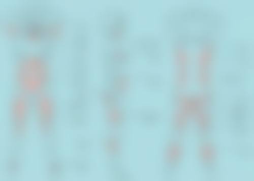 三、不同类型疤痕的修复特点和护理重点