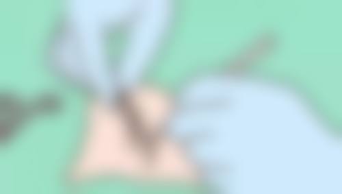 二、正常反应与异常情况对比