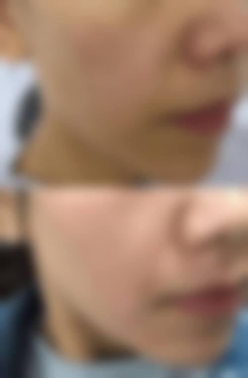 五、李宰旭怎么预约？