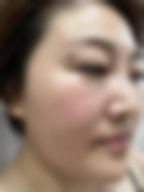 四、李宰旭收费价格表