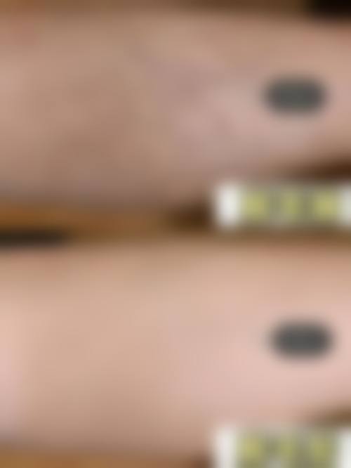 四、宜宾市第二人民医院整形美容科特色项目