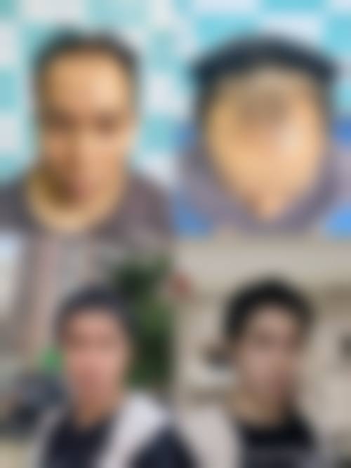 四、兰州青丝亿植发诊所特色项目