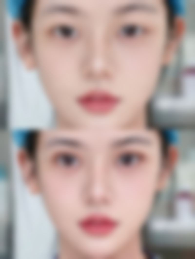 三、何谦技术优势