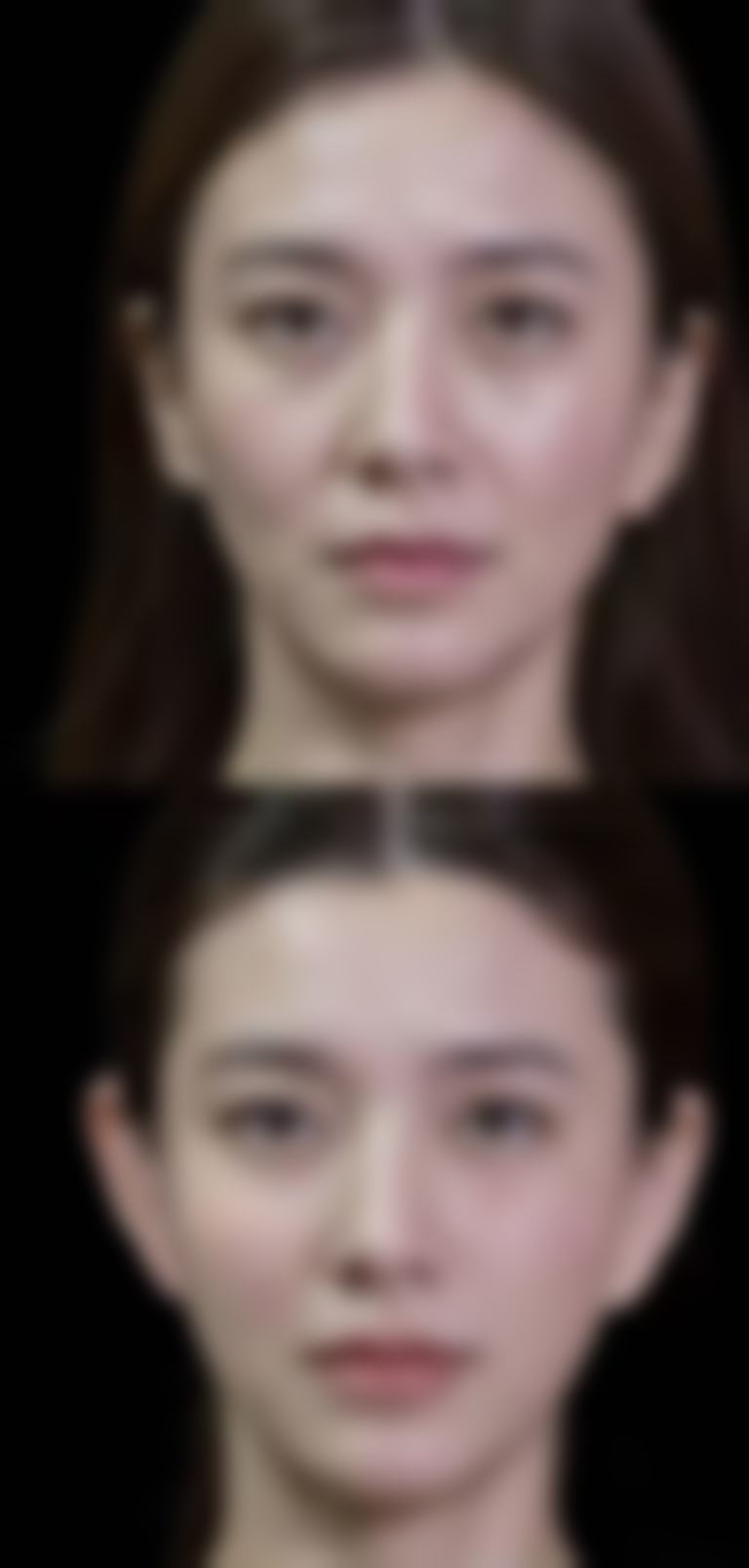 二、芦荟胶对手术疤痕的作用