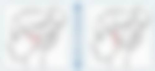 三、切双眼皮和切眉的手术关键差异对比