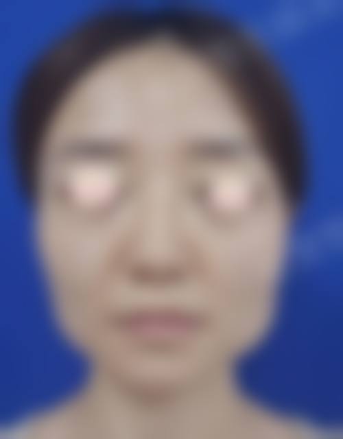 四、南通柒颜医疗美容诊所特色项目