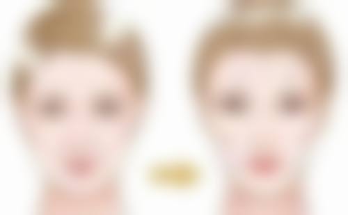 四、隆胸脂肪填充的美学设计与形态变化