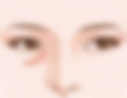二、全切双眼皮之后多久可以化妆