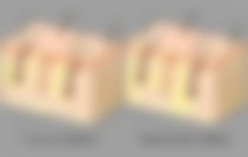 二、不同类型下眼袋肿的消除方法