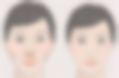 五、双眼皮手术后饮食的其他注意事项