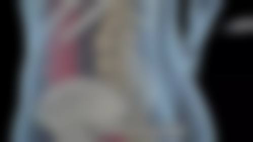 八、乌鲁木齐伊栀美医疗美容诊所真实的患者评价