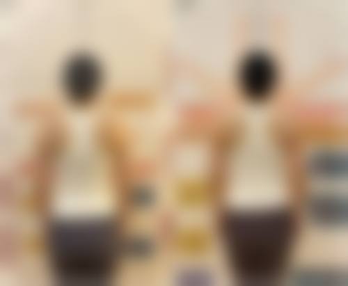 二、枣庄悦然整形医院怎么样？