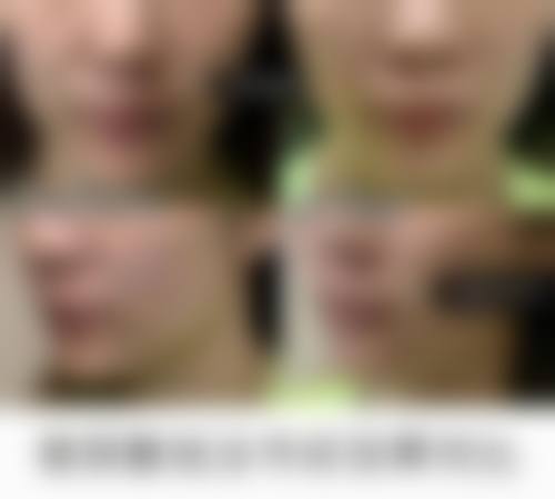 五、济南蓝石医疗美容诊所价格表