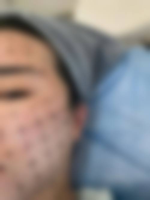 四、乌鲁木齐伊栀美医疗美容诊所特色项目