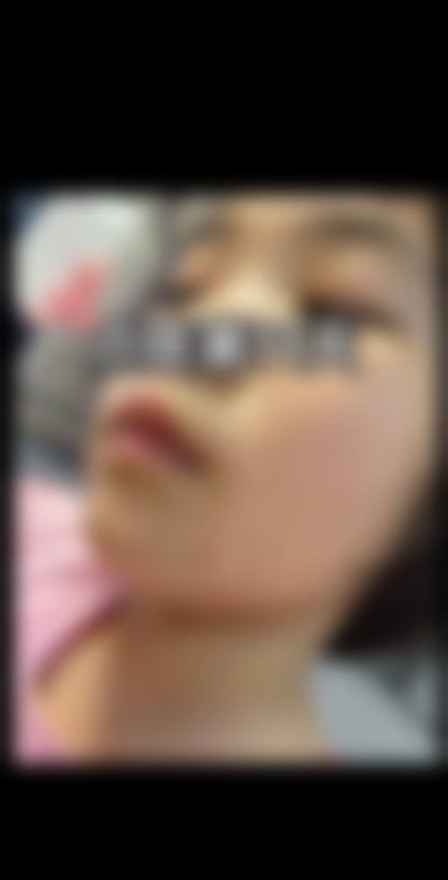 八、济南蓝石医疗美容诊所真实的患者评价