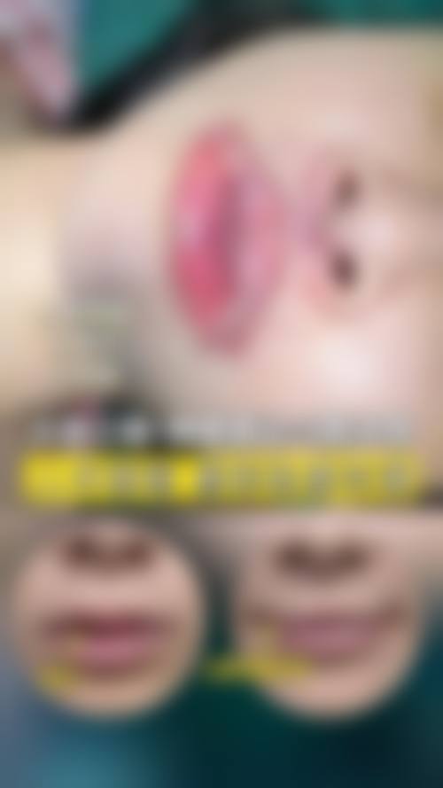 四、枣庄悦然整形医院特色项目