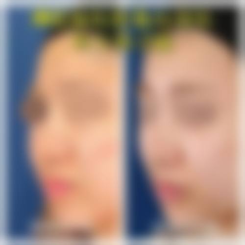 七、枣庄悦然整形医院预约方式