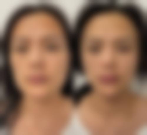 二、蔡小婷擅长项目