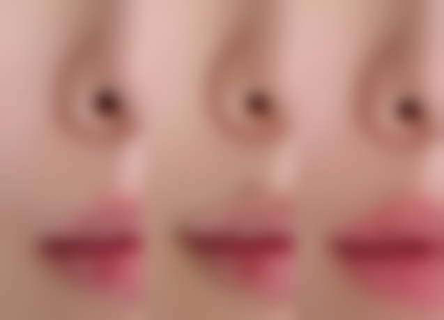 四、术后修复期间的其他注意事项